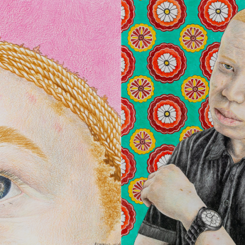 Archer Asks: Artist Kwinana on art and activism for People With Albinism in South Africa
