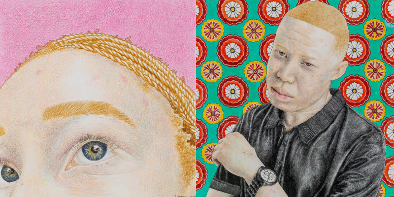 Archer Asks: Artist Kwinana on art and activism for People With Albinism in South Africa